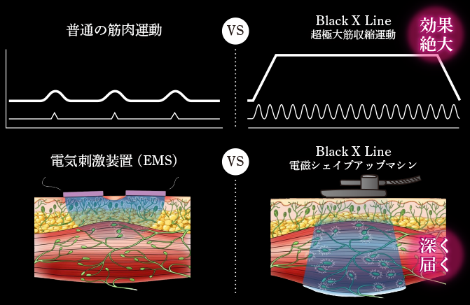 BLACK X LINE　ブラックエックスライン　電磁シェイプアップマシン